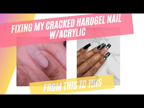 Repairing my Cracked Gel Nail w Acrylic | UUGGGHHHHHH!!