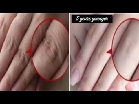 Diy Hand Mask|how to treat dry hands at home|dry hand treatment at home| Dry Cracked Hands