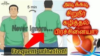 Are you suffering from "Frequent urination" /Frequent urination symptoms & treatment explained tamil