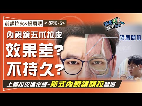 前額拉皮&提眉眼（須知-5）內視鏡上額拉皮再進化！ 改良傳統五爪前額內視鏡拉皮缺點  抬頭紋/皺眉紋/眉眼下垂/M型禿 一次搞定！ 科普醫美新知 370-20241214