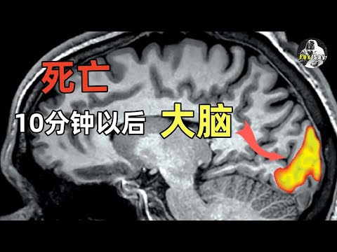 死亡之后，大脑为什么会突然开始高速运转？