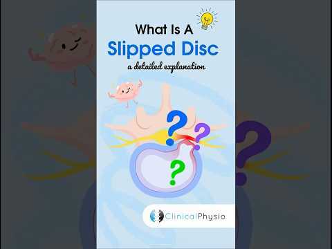 Slipped Disc Explained #physicaltherapy #physiotheraphy #slippeddisc #anatomy