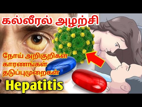 கல்லீரல் அழற்சி | Hepatitis viral infection explained in tamil | Liver problem symptoms in tamil