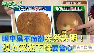 眼中風不痛卻突然失明！ 視力突然下降要當心 健康2.0