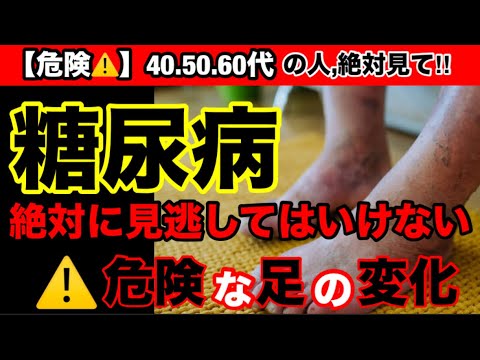 【超危険】糖尿病の初期症状がヤバすぎた！糖尿病の予防方法とオススメ食材３選！