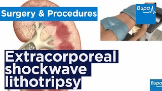 How extracorporeal shockwave lithotripsy is used to treat kidney stones | Bupa Health