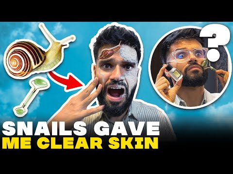 Testing Viral Skin Care Products For Clear Skin ft. Korean Skincare | BeYourBest Skincare San Kalra