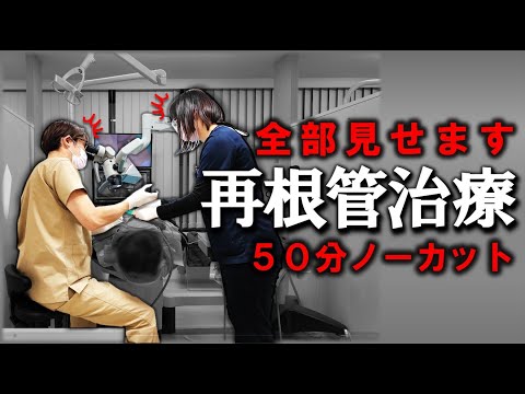 これ以上の治療は難しい…と言われた歯の再根管治療　肉眼では見えない歯の神経…治らない理由はコレ！　#MB2　#歯医者