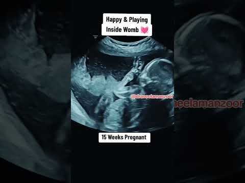 15 Weeks Pregnant| 15 weeks baby ultrasound scan