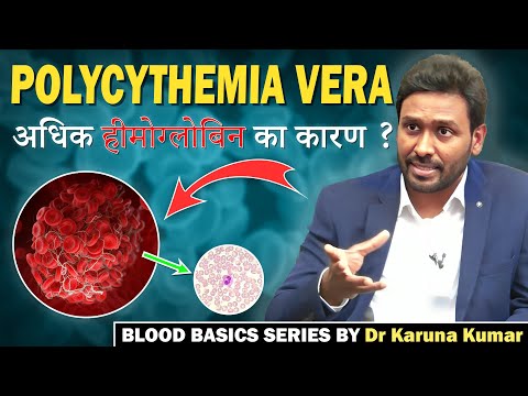 What is Polycythemia Vera | Erythrocytosis Vs  Blood Cancer | Dr Karuna Kumar