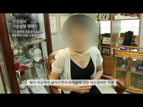 민경원의 가슴설렘카페, 가슴설렘 캠페인 1기 유방재건 그 후 이야기_