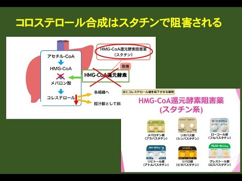高コレステロール血症の治療を検証する