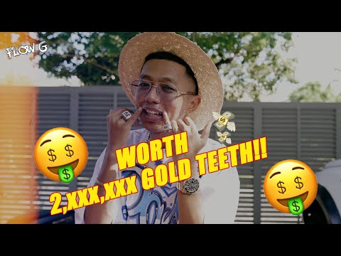 GOLD TEETH WORTH (2,XXX,XXX)