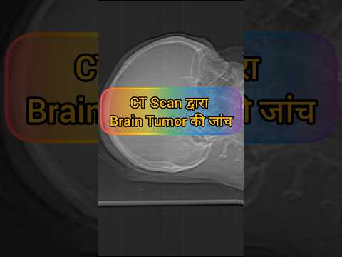 CT Scan द्वारा Brain Tumor Ki जाँच|NCCT HEAD| #anatomy #neetmotivation