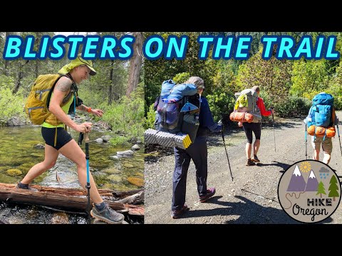 How To Deal With Blisters On The Trail & How To Prevent Them