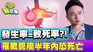 發生率等於死亡率？ 罹患 膽管癌 恐半年內死亡？！癌中之王特徵要小心【江P醫件事#55】