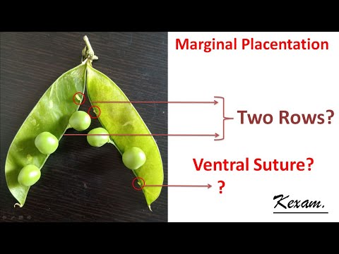 Marginal Placentation Explained. NBD#5. kexam. #NEET