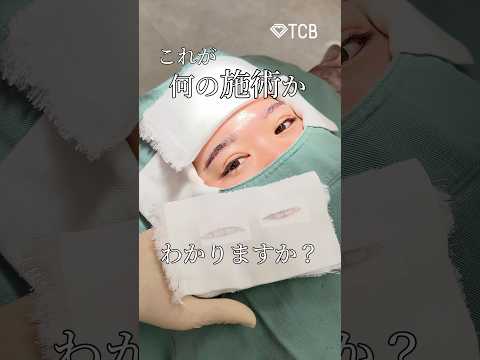 【眉下リフト】なんの施術…？？#shorts