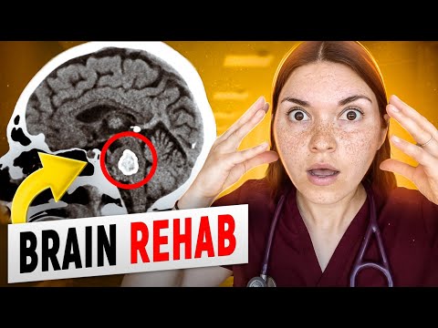 Day in the Life of a Doctor: Shadowing an Occupational and Physical Therapist (Ft. Stroke Rehab)