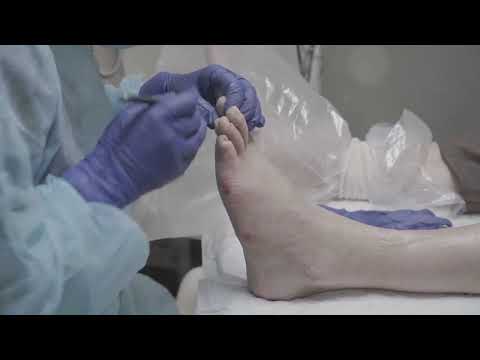 Medical clinic New York | 212-933-9023 | TD Podiatry