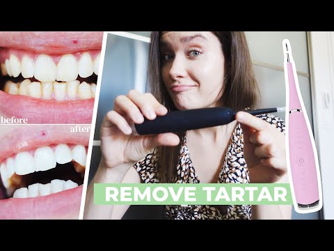 HOW TO REMOVE CALCULUS TARTAR PLAQUE AT HOME | Ultrasonic Tooth Cleaner Review - Does It Work?