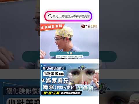 饅化臉修復指南-5｜解剖學權威收治「小針美容」取出、「過度填充」異物清除【真實個案分享】 饅化臉修復選錯方式 小心造成二次傷害 科普醫美新知367-20241122