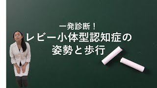 レビー小体型認知症の姿勢と歩行