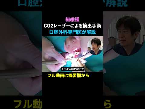 【繊維種／21歳女性】CO2レーザーによる摘出手術ノーカット解説（口腔外科専門医 安原豊人）