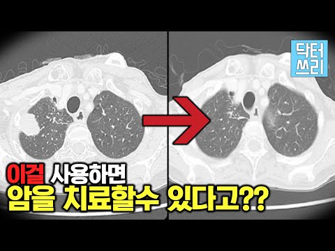 암 치료에는 이걸 먼저 해보세요 - 암의 불씨를 꺼버리는 기적의 이것은? (암예방과 암치료의 새로운 접근 방법)