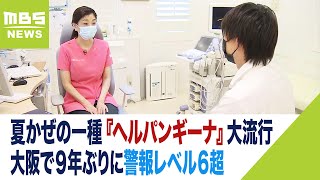 発熱や“のどにぶつぶつ” 大流行『ヘルパンギーナ』は医師や保護者の判断難しい点も（2023年6月23日）