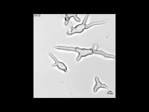 Pseudomonas aeruginosa inhibits Rhizopus microsporus germination through sequestration of free