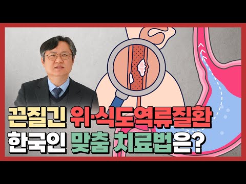 역류성식도염 치료, 꼭 약을 장기간 복용해야 하나요?