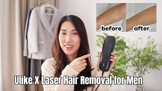 Ulike X Laser Hair Removal for Men Review |The Perfect Self-Care Gift for Men | Chris Han