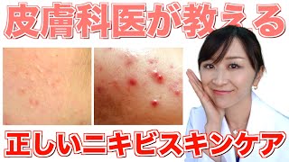 皮膚科専門医が教える正しいニキビのスキンケア