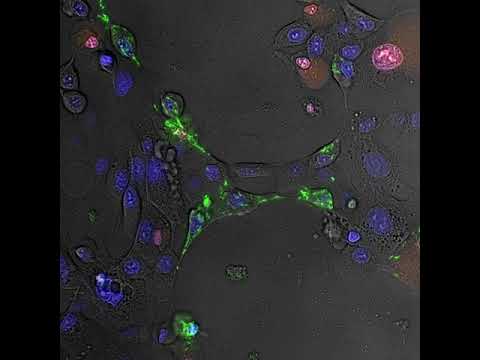 Pseudomonas Infection Timelapse