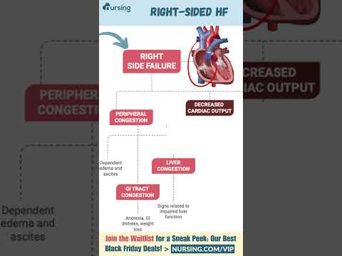 Heart Failure🫀- Left sided vs. Right sided