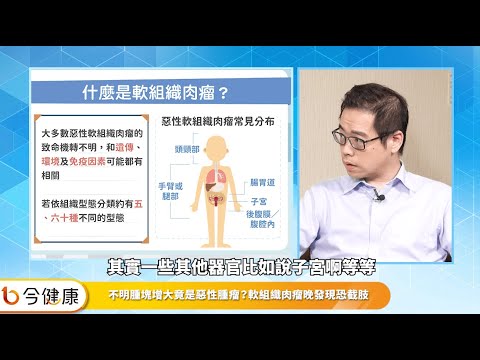 身上不明腫塊是惡性腫瘤？軟組織肉瘤復發怎麼辦？接續標靶治療新希望