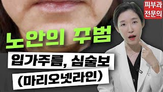 (*Eng) 입가주름, 심술보? 마리오넷 라인 필러로 해결! - 피부과전문의 [닥터필러]