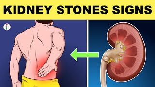 Kidney Stones Symptoms - All You Need to Know