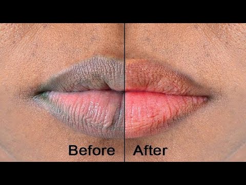 How To Lighten Dark Lips - 5 Home Remedies For Smoker Lips | Top 5.