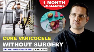 Varicocele natural treatment | Varicocele treatment without any surgery | Dr. Gaurav Gangwani