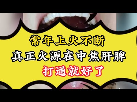 常年上火不断，真正火源在中焦肝脾！打通就好了