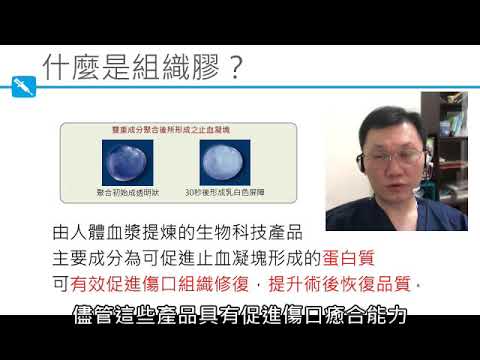 20180927 組織膠如何提升減重手術安全性 台灣減重手術權威蔡明憲教授解說版