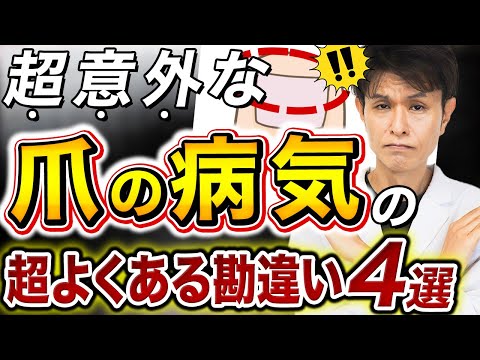 爪の病気は水虫だけじゃない？爪が白い時や爪が黒いとき、皮膚科医が解説する爪のよくある勘違い４選