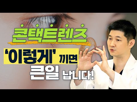 안과의사가 컬러렌즈를 절대 추천하지 않는 이유! - 솔직한 안과 #5