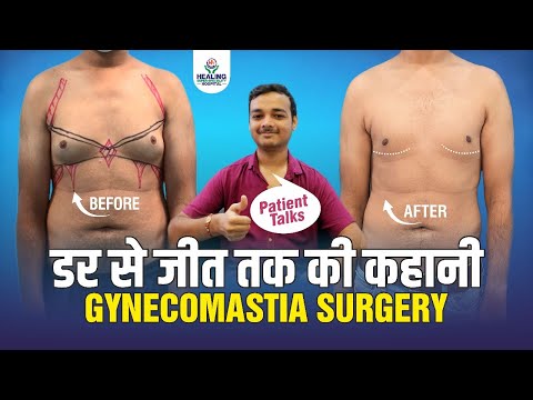 Success Story of Gynecomastia Surgery | Men Breast Treatment | Healing Hospital Chandigarh