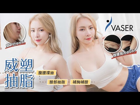 Vaser2.2威塑抽脂腹腰環抽.臉部抽脂.抽脂後補胸補臉手術心得分享 ~