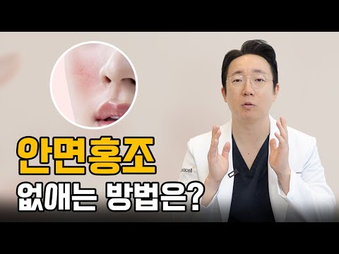 홍조 치료는 어떤식으로 진행이 되나요?  │홍조