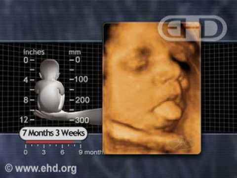 Fetus 7 1/2 months -- Breathing Movements