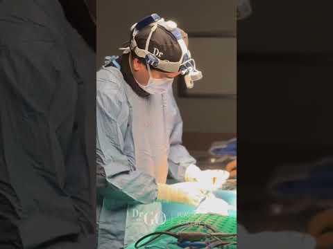 Behind the Scenes: A Day in Rhinoplasty Surgery with Assoc. Prof. Dr. Güncel Öztürk